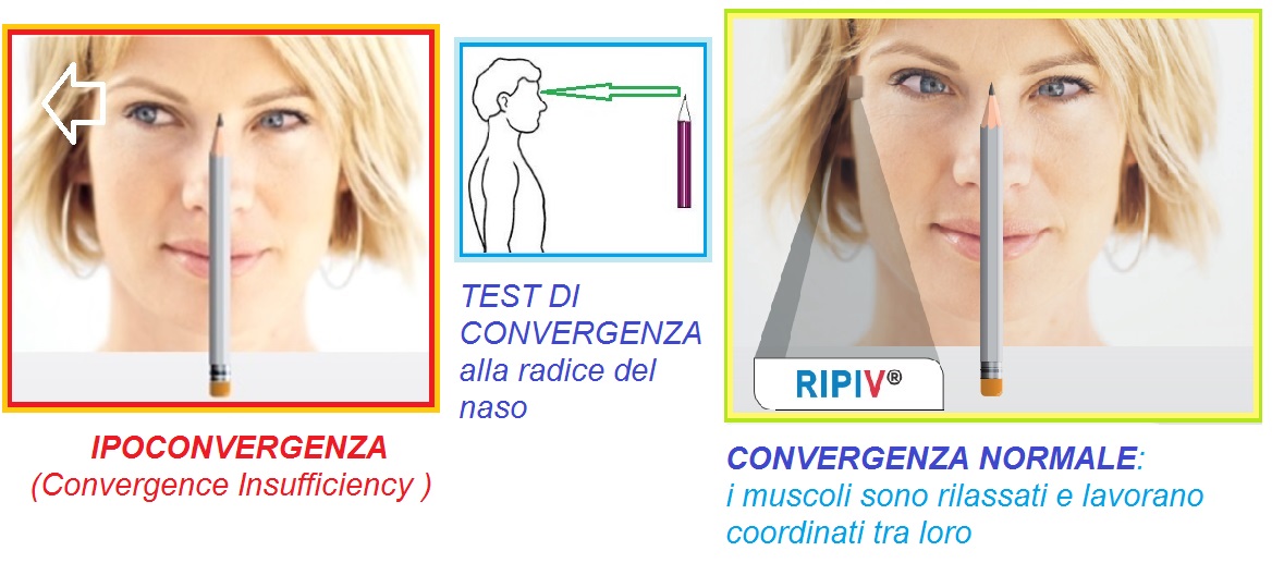 RIPI V riequilibratore posturale permanente ad infrarossi a ingresso visivo  – Italian Ingenuity RIPI SRL